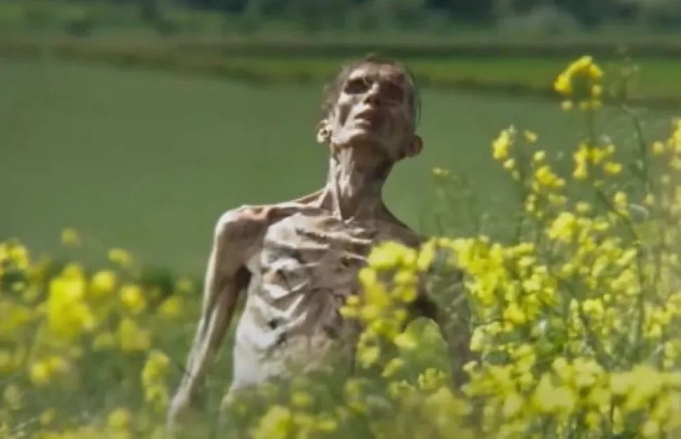 A severely emaciated, skeletal human figure stands in a field of yellow flowers, looking upward with a gaunt, sunken face…