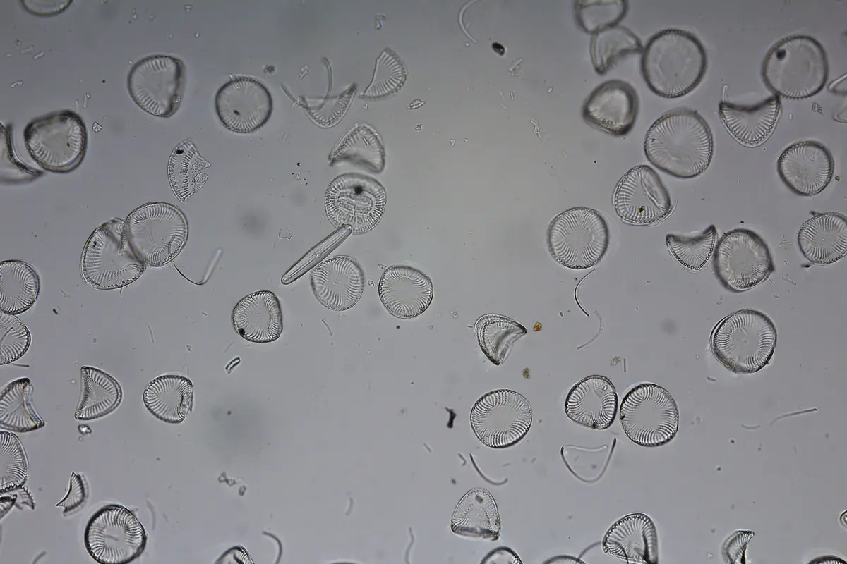 A microscope image shows numerous circular, ribbed diatom shells scattered across a gray background, with one elongated…