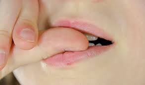 A close-up image shows a person's mouth with their thumb inside, biting down on it. The person's lips are slightly parted…