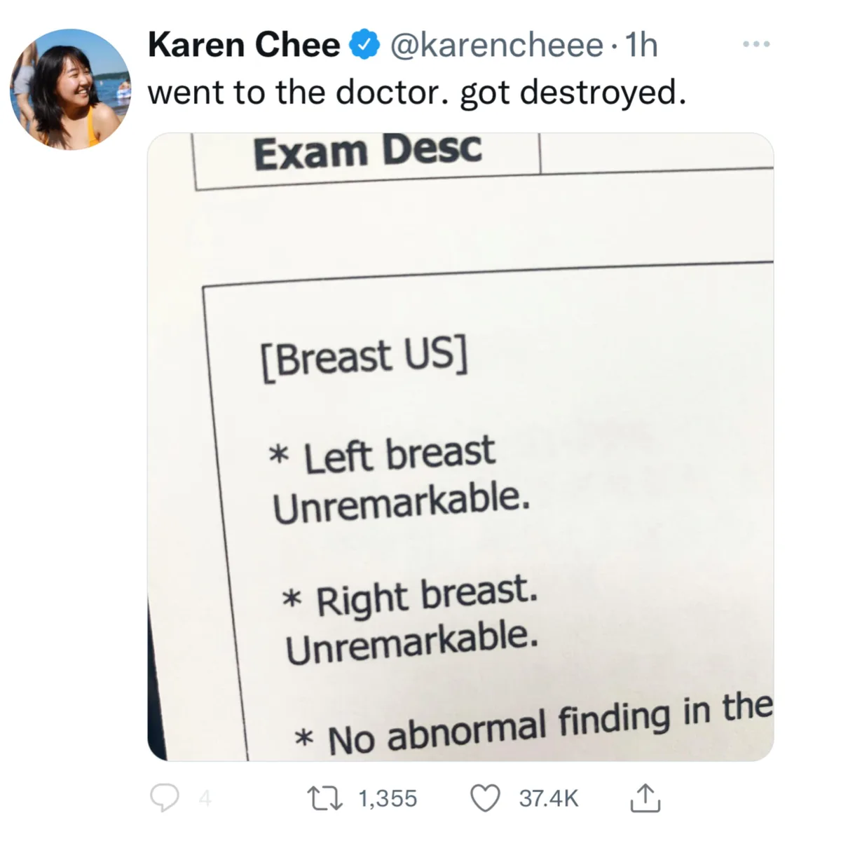 A close-up photo of a medical report under 'Exam Desc' shows a breast ultrasound result with 'Left breast Unremarkable.' and…