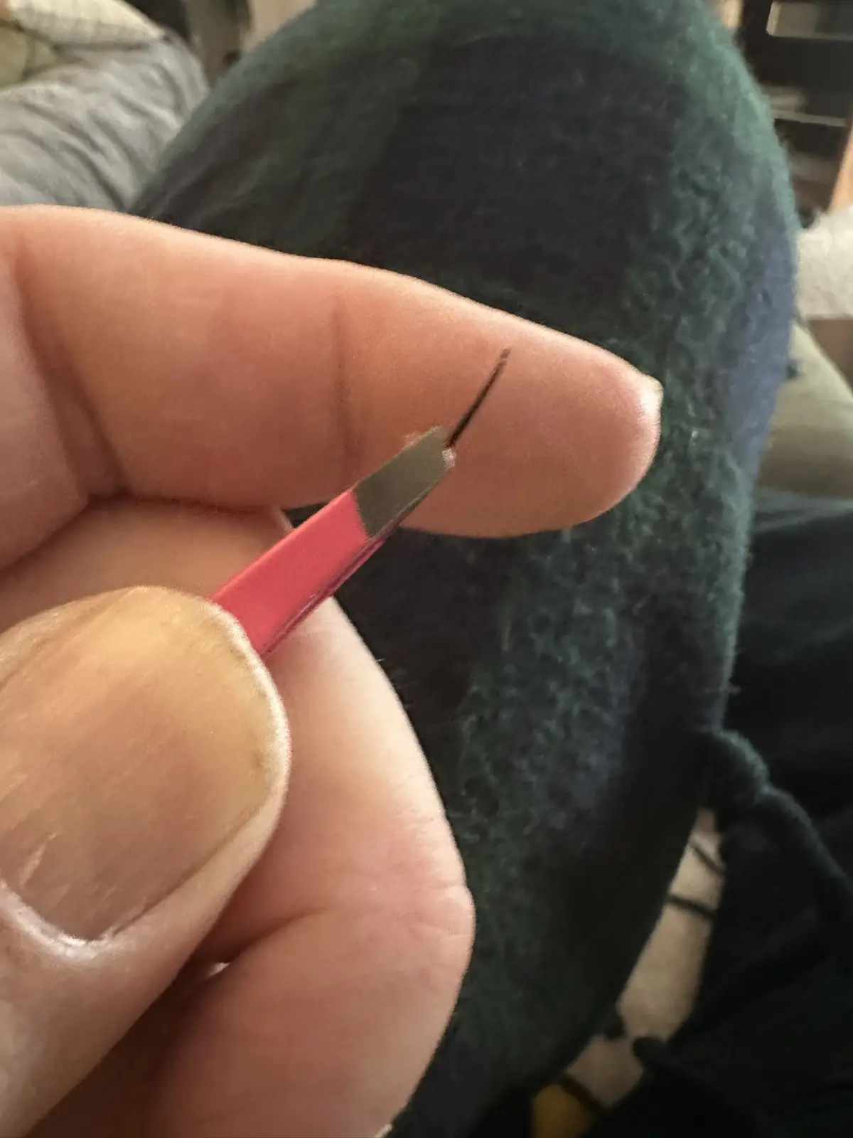 A close-up photo shows a person's hand holding a red-handled tweezers with a single dark hair stuck to its metal tip. The…