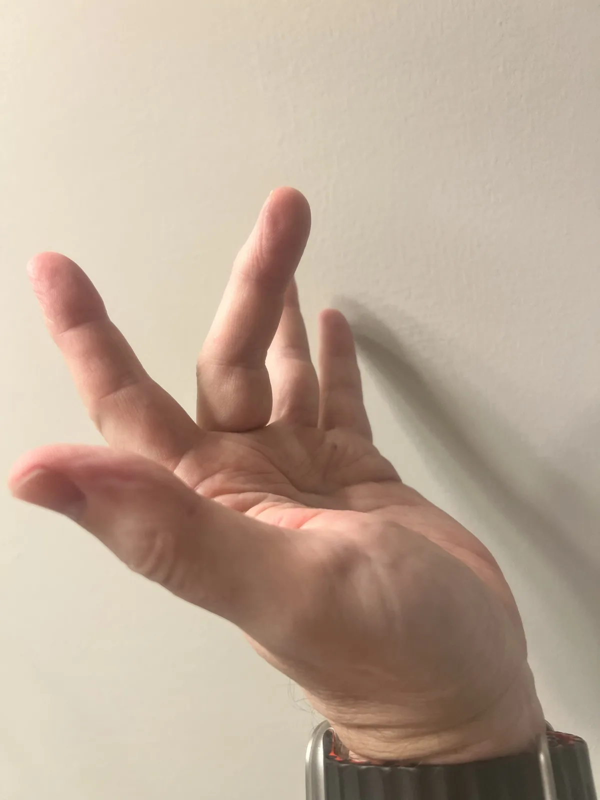 A close-up photo shows a person's left hand against a plain white wall, with the thumb and index finger extended upward…