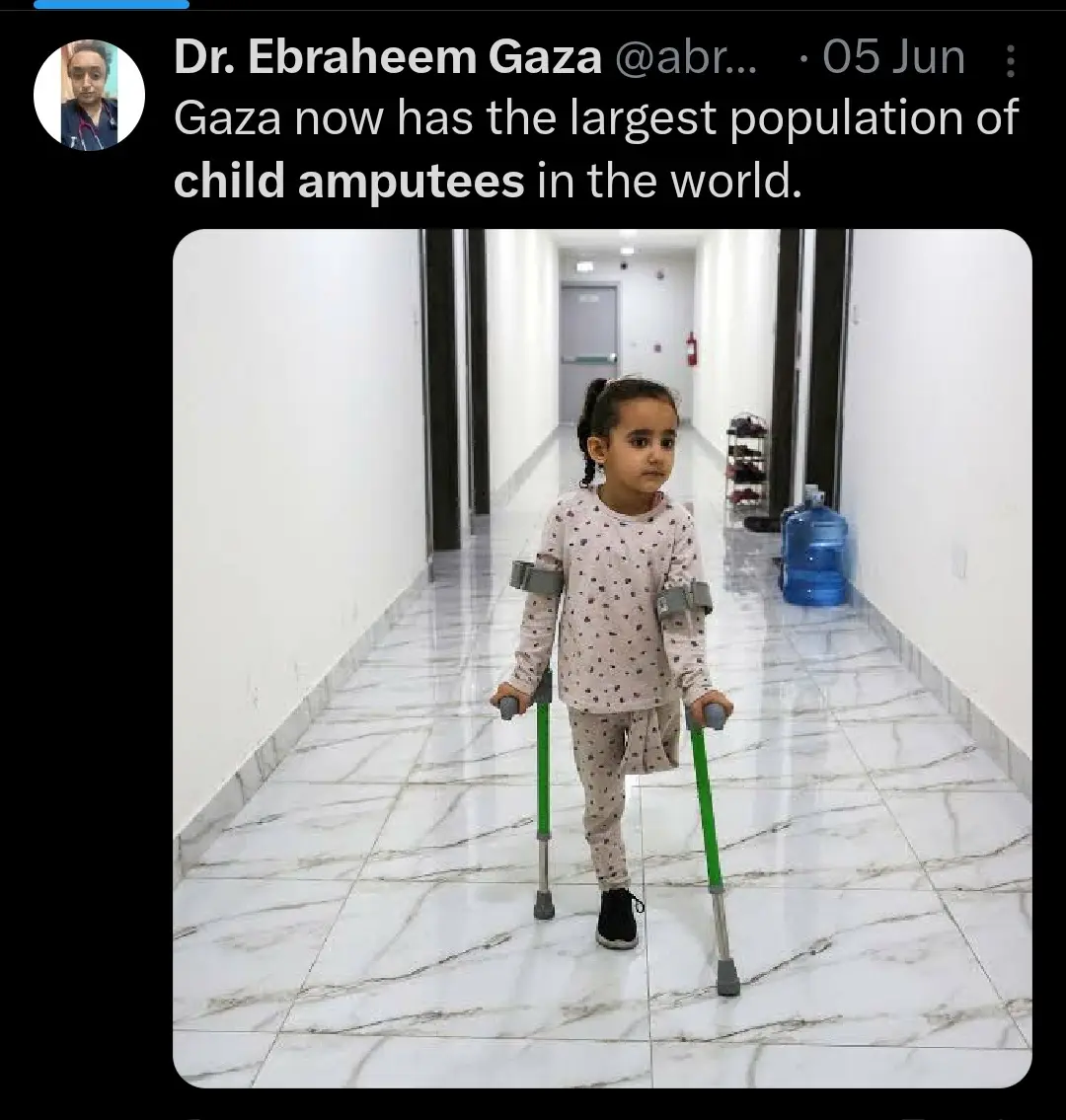 A young girl with dark hair in braids stands in a brightly lit hallway with white marble floors, using green crutches. She…