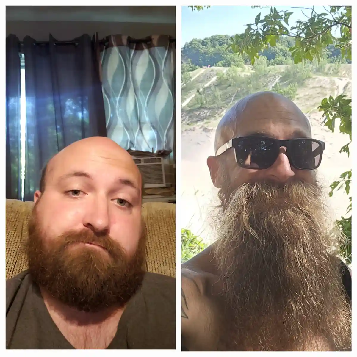 A split-screen image shows the same bald man with a beard in two contrasting settings: left, indoors on a couch with…