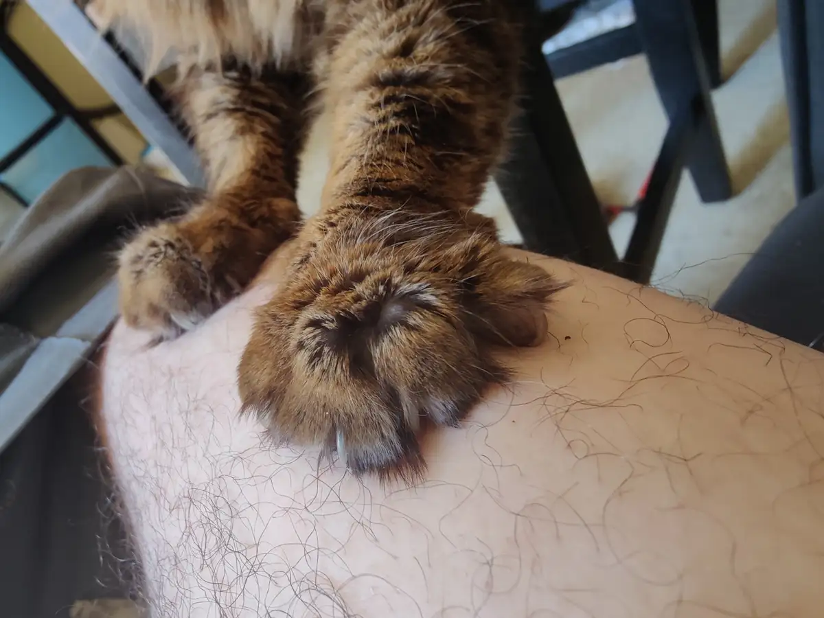 A close-up photo shows a fluffy brown tabby cat's paws resting on a person's hairy leg. The cat's fur is thick and striped…