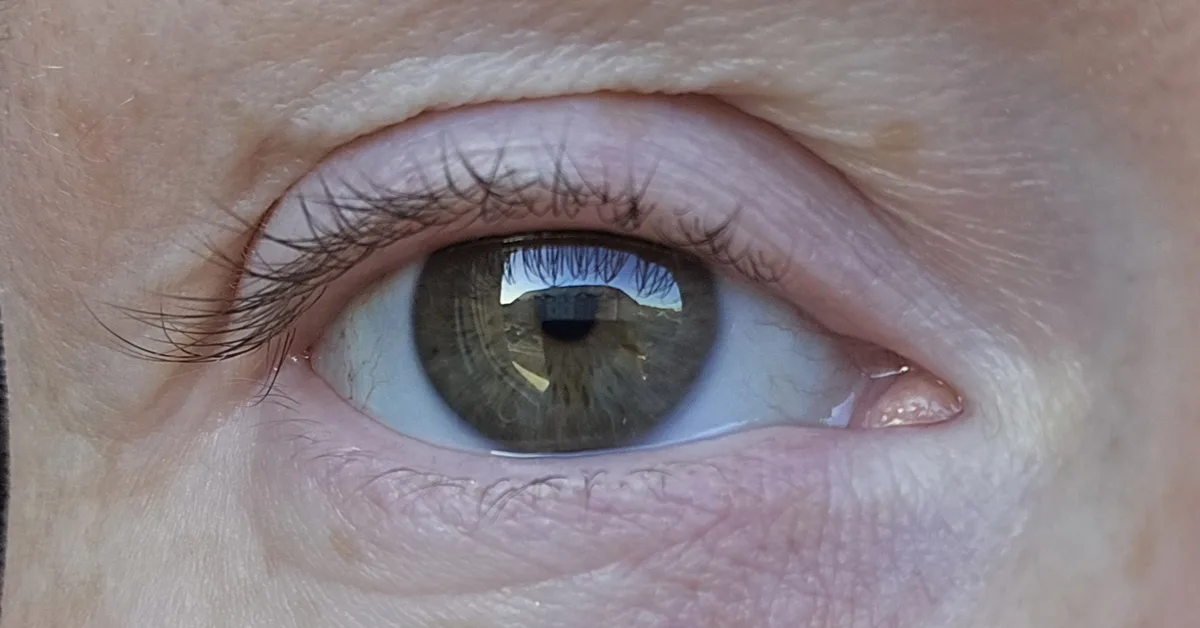 A close-up photo of a human eye with visible eyelashes, skin texture, and a reflection of a building in the pupil. The…