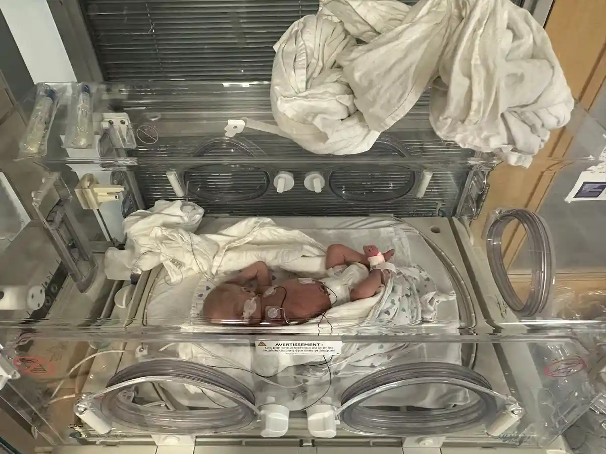 A newborn baby lies in a transparent hospital incubator, connected to medical sensors and tubes, with white blankets…