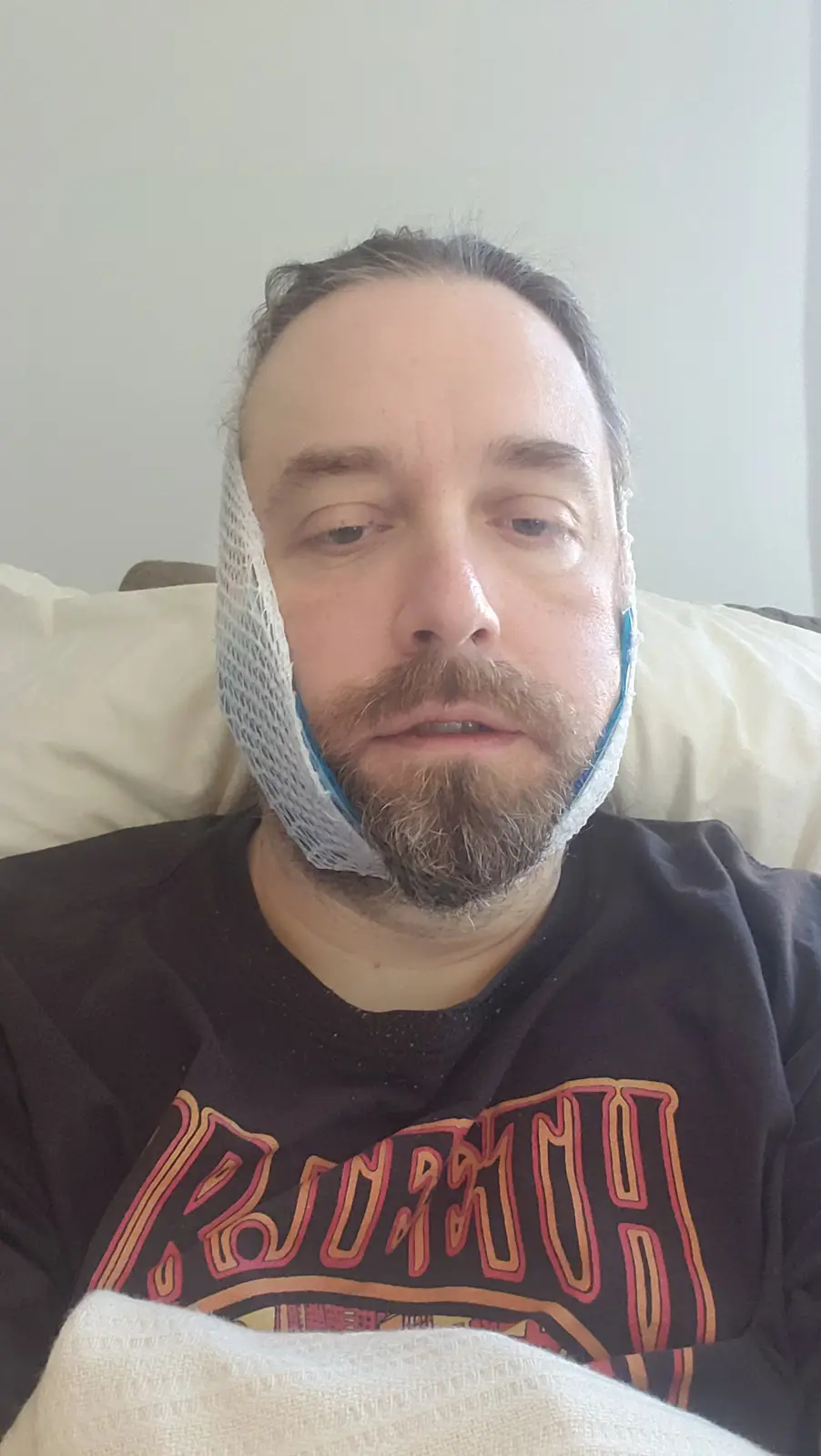 A man with a beard sits on a couch wearing a white mesh face mask that covers his cheeks and jawline, leaving his nose and…