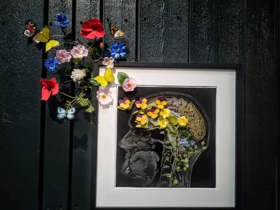 A framed black-and-white MRI scan of a human head is decorated with colorful paper flowers and butterflies, which appear to…