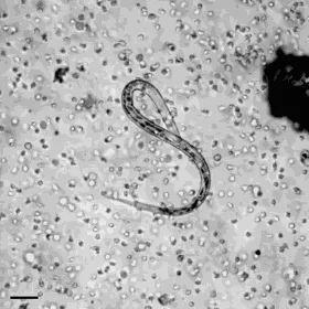 six sequential microscopic images show a worm-like organism gradually becoming increasingly blurry and pixelated across…