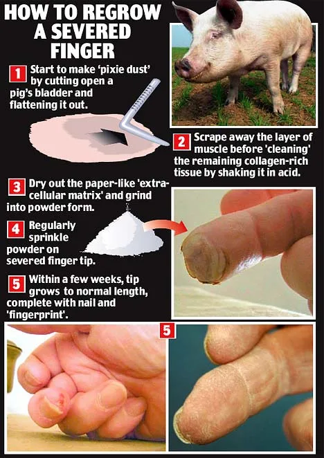 A satirical infographic titled 'HOW TO REGROW A SEVERED FINGER' presents five absurd steps using pig anatomy and acid. Step…