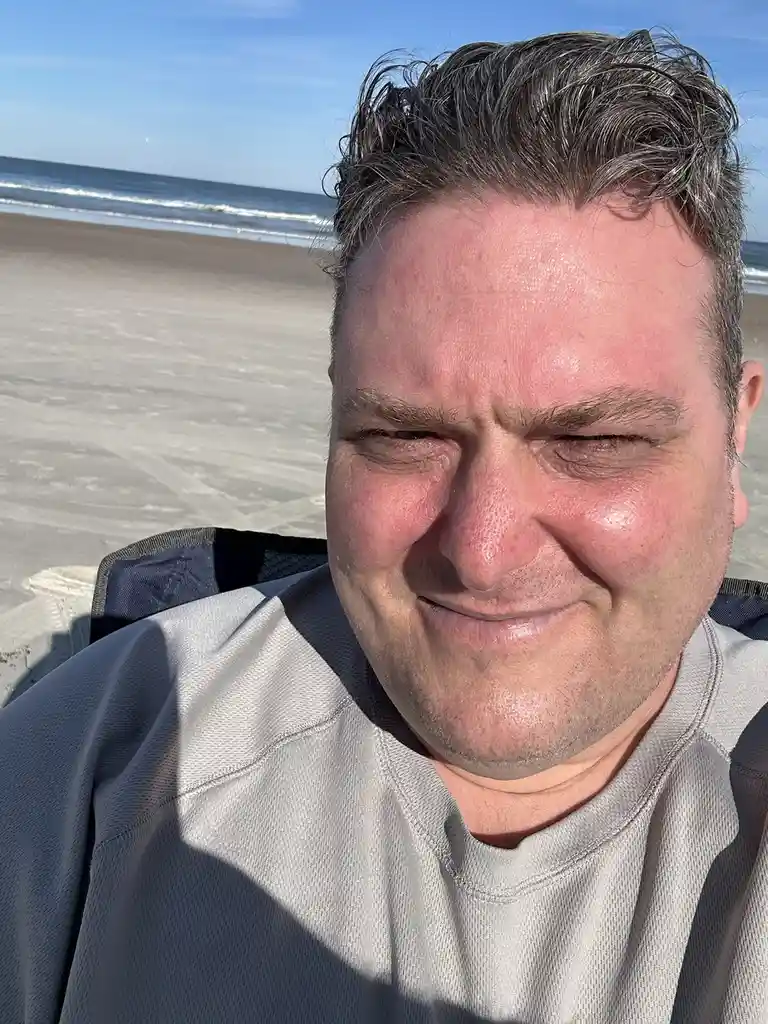 A man with sunburned, red skin and squinting eyes sits on a beach chair, smiling at the camera with a background of ocean…