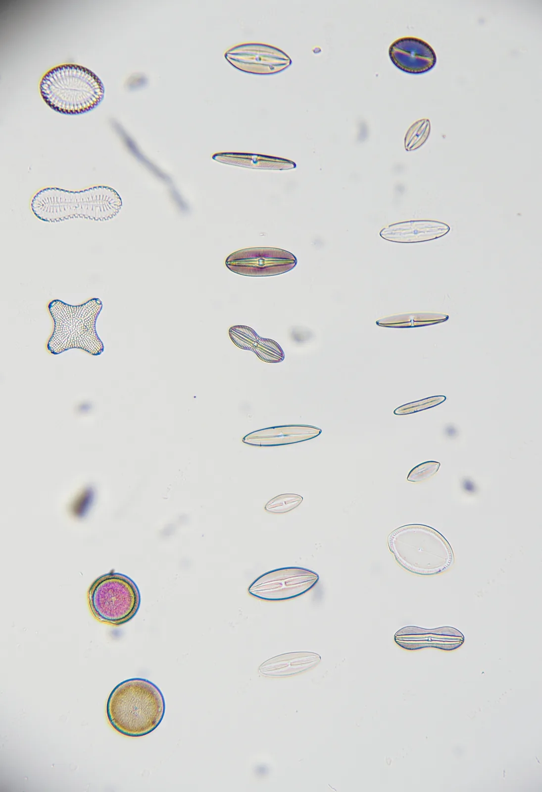 A microscope image shows numerous small, translucent, oval-shaped diatoms and other microscopic organisms floating in water…