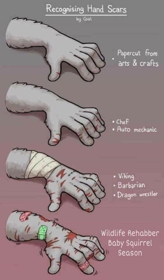 The image displays four cartoon-style hands with varying types of scars, each paired with text describing the likely cause…