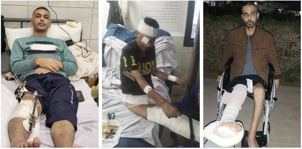 A three-panel image shows a man in a hospital bed with a leg injury and external fixator, then with a head bandage and eye…