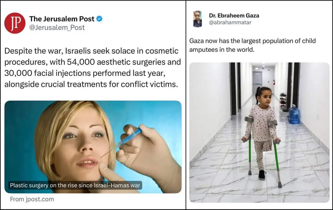 The image displays two side-by-side Twitter posts. The left shows a photo of a woman receiving a facial injection with text…