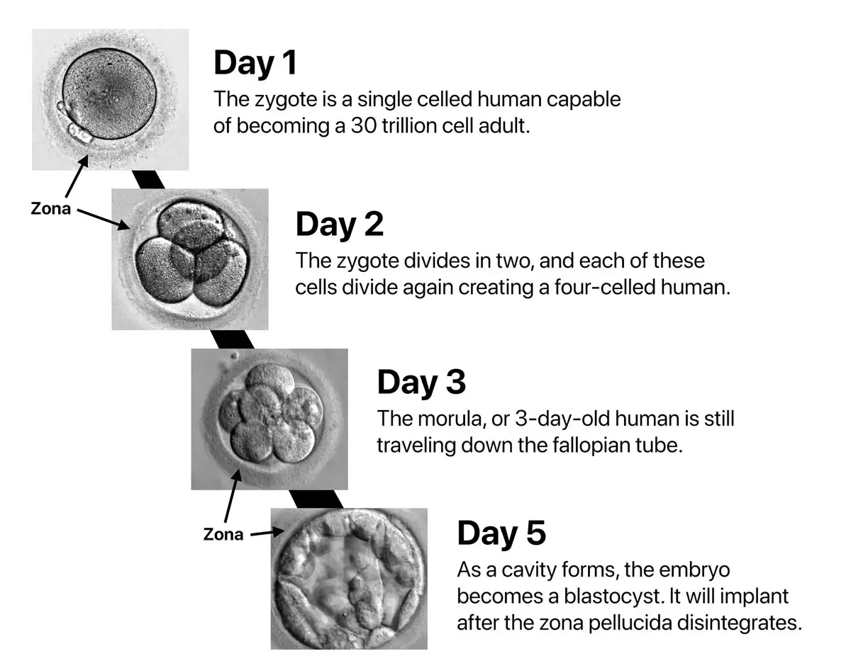 A diagram showing the early stages of human embryonic development from day 1 to day 5, with microscopic images of the…