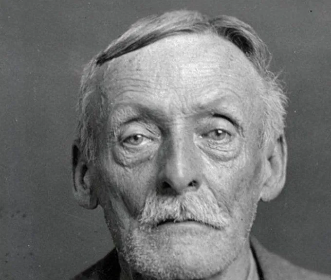 An X-ray revealing the shocking secrets of serial killer Albert Fish's pelvis.