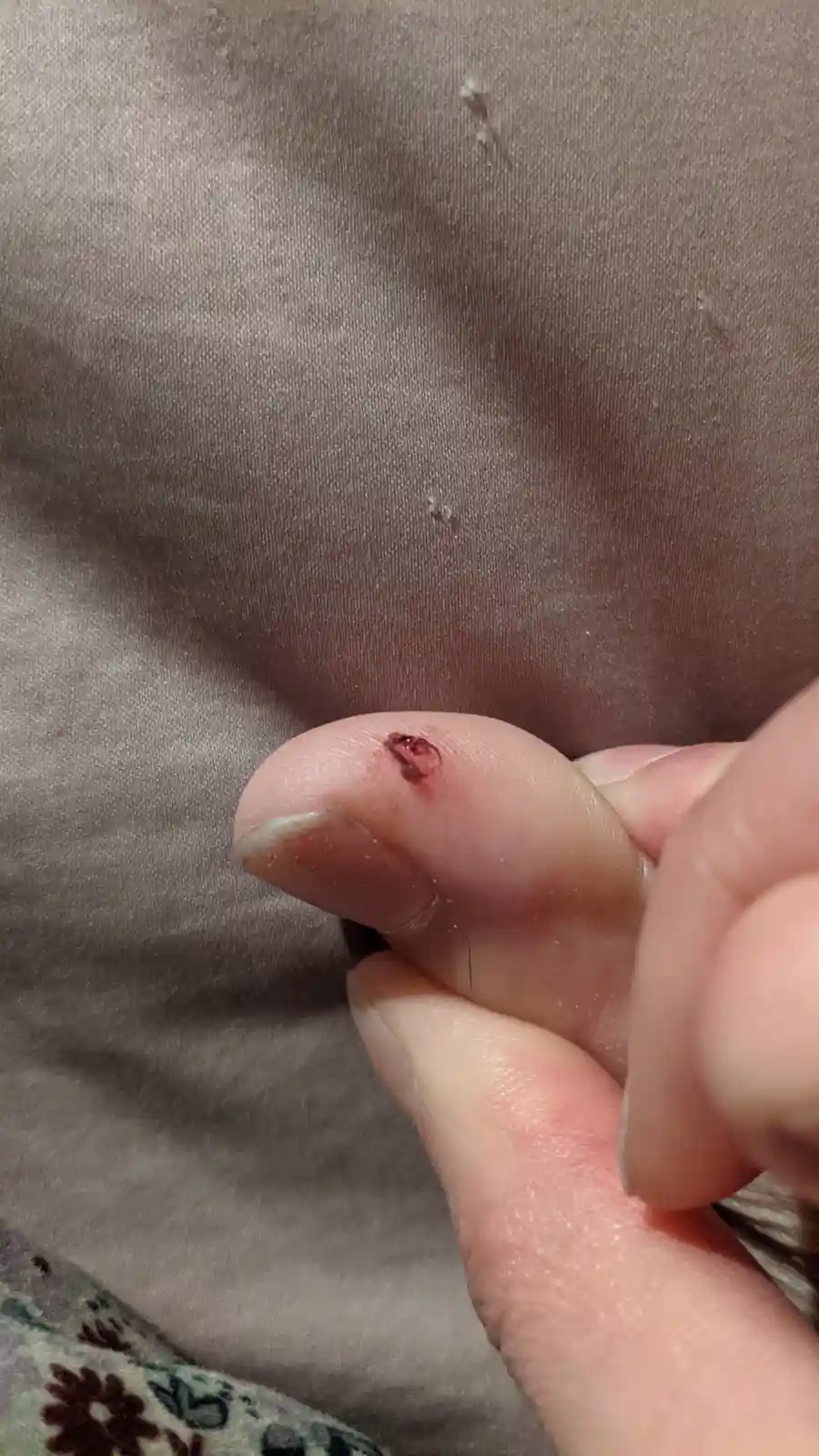 A close-up photo shows a person's finger with a small, fresh cut near the fingertip, bleeding slightly, against a brown…