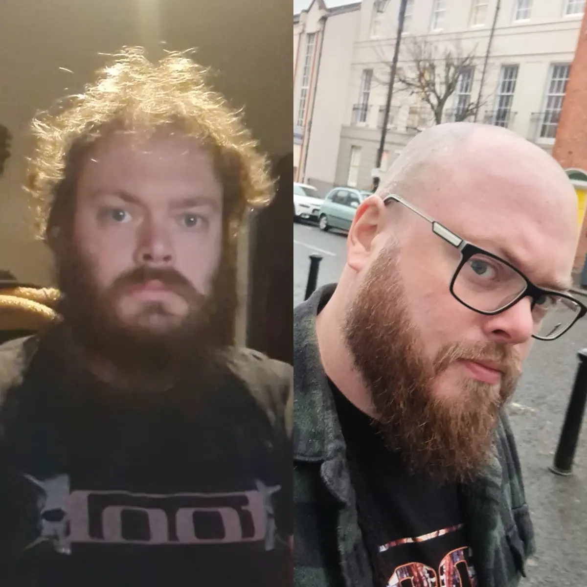 A split image shows the same man with a full head of curly blonde hair and beard on the left, and the same man with a shaved…