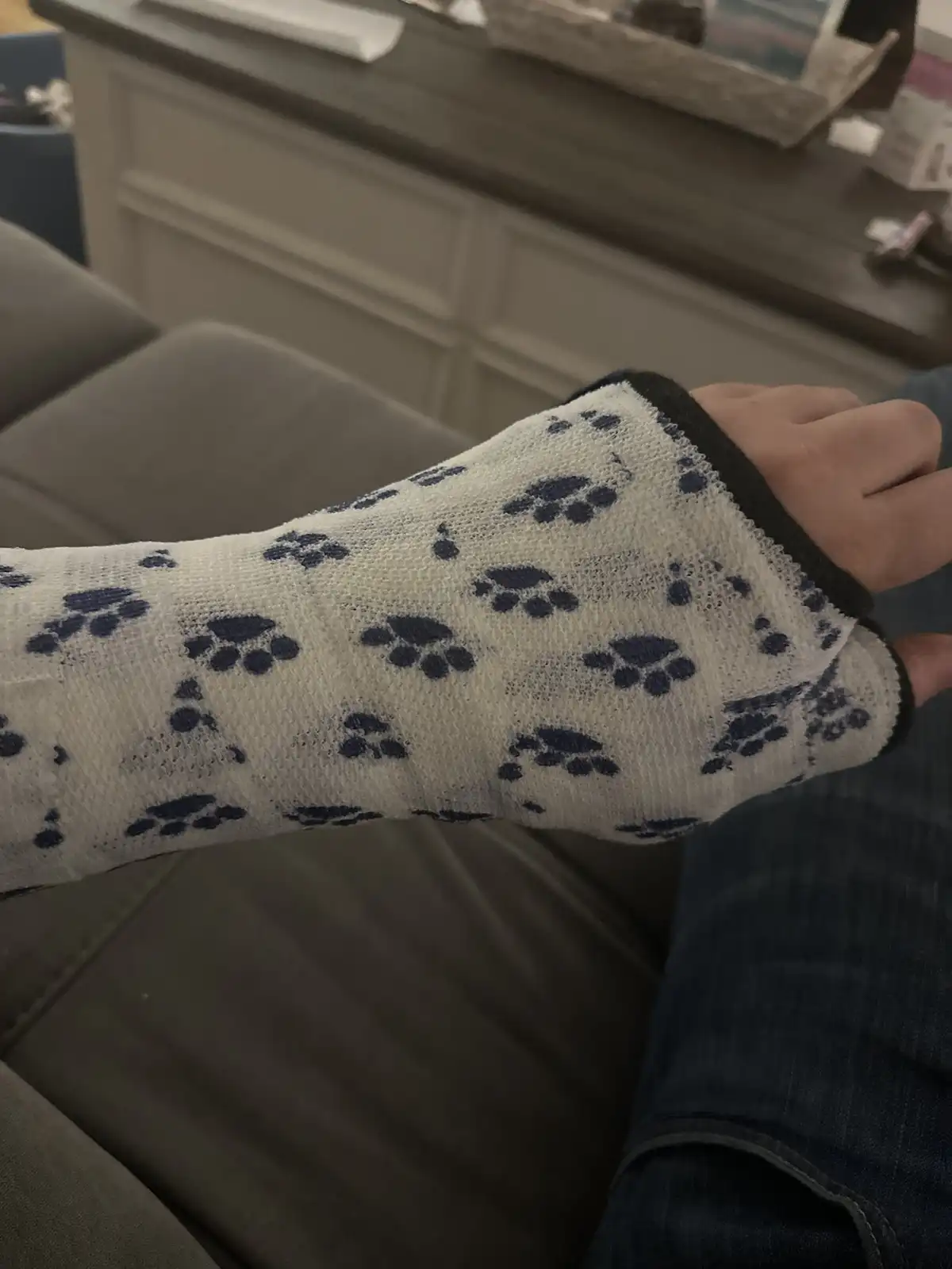 A person's arm is shown in a white, knitted cast decorated with blue paw prints, resting on a couch. The cast covers from…