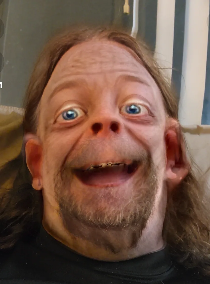A close-up photo of a man with long brown hair and a beard, wearing a black shirt, whose face is heavily distorted by a…