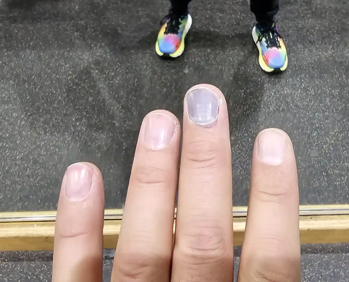 A close-up shot shows four fingers with clean, unpolished nails against a dark speckled floor, with colorful rainbow…