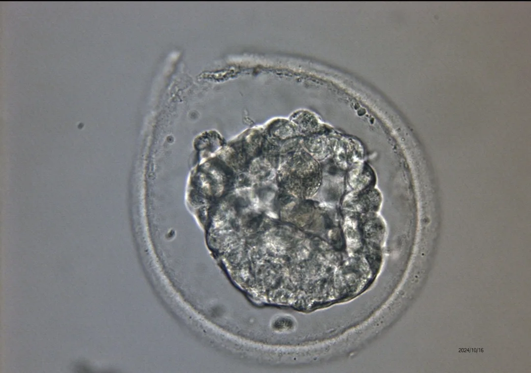 A microscopic image shows a developing embryo, likely a blastocyst, with a distinct inner cell mass and outer trophoblast…